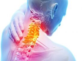Pain and accommodation in the cervix zone with the third degree of osteochondrosis