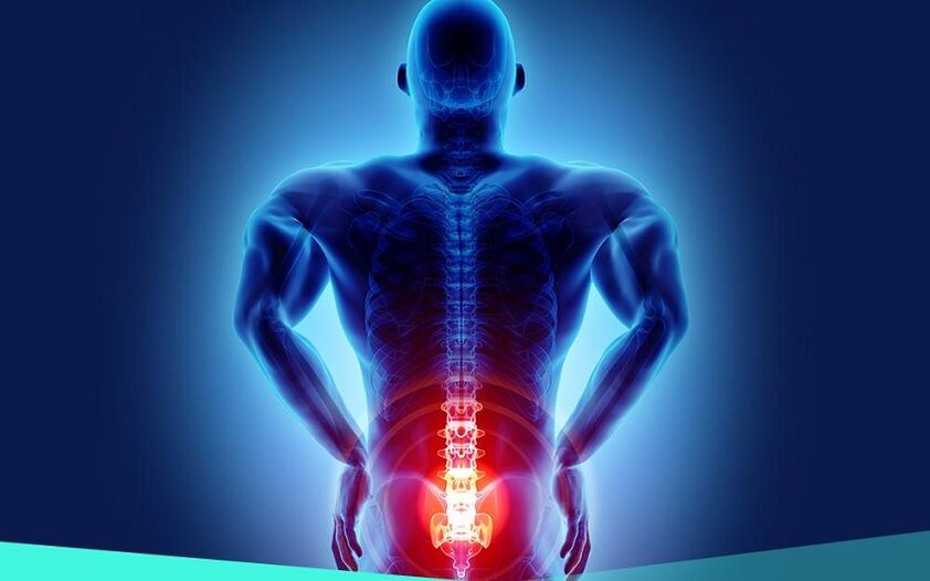 Pain due to hip osteoarthritis